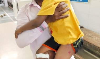 कोलगाव येथे भटक्या कुत्र्याने चावा घेतल्यामुळे  बालक जखमी.