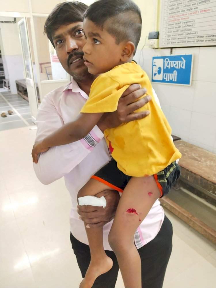 कोलगाव येथे भटक्या कुत्र्याने चावा घेतल्यामुळे  बालक जखमी.
